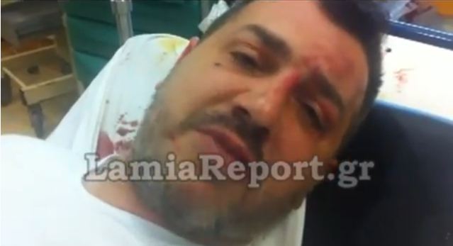 Βίντεο-Ο 37χρονος περιγράφει πώς τον πυροβόλησαν