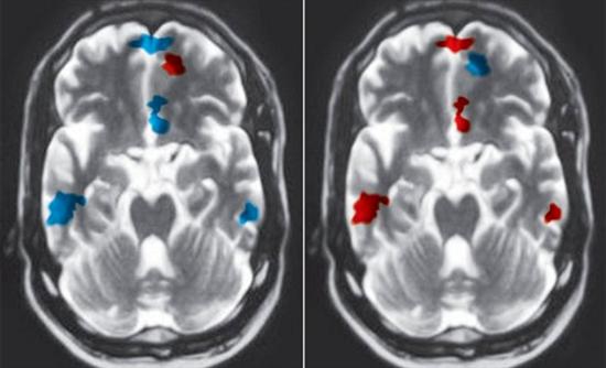 Δείξε μου τη μαγνητική σου να πω αν με αγαπάς