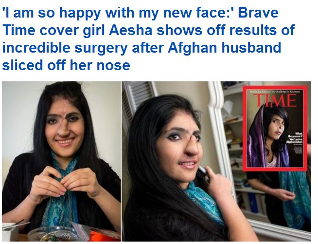 ΦΩΤΟ – Φρίκη! Της έκοψε τη μύτη και τα αυτιά