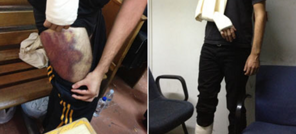 Ερώτηση ΣΥΡΙΖΑ για τις φωτογραφίες του Guardian