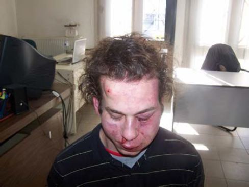 Σοκάρουν οι φωτογραφίες των συλληφθέντων