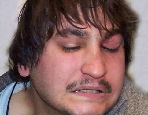 Ταυτοποιήθηκε το DNA του “τοξοβόλου” με 2η ληστεία