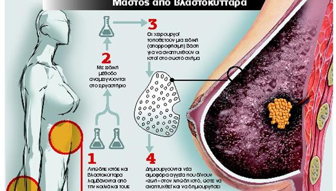 Τέλος εποχής για τη σιλικόνη