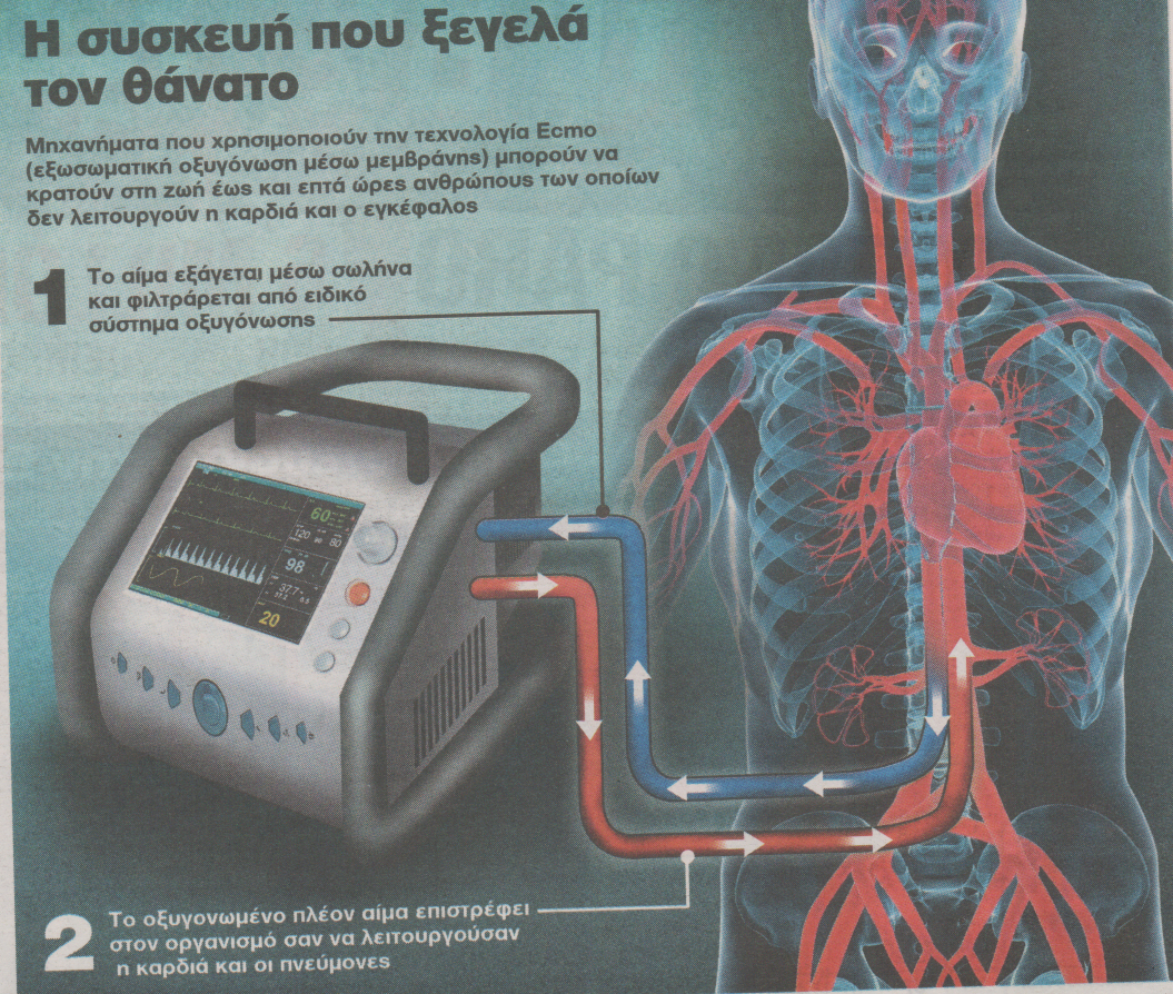 Έζησε επτά ώρες χωρίς καρδιά και εγκέφαλο