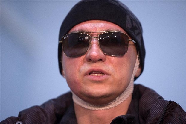 Ομολόγησαν την επίθεση στον διευθυντή των Μπολσόι