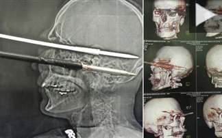 «Καμάκωσε» τον εαυτό του