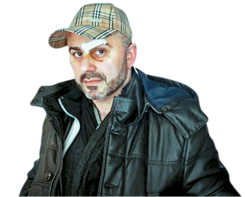 “Φορούσαν μαύρα αυτοί που με χτύπησαν”