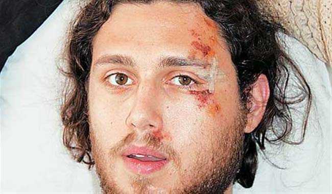 Σερβιτόρος της καφετέριας ένας εκ των δραστών