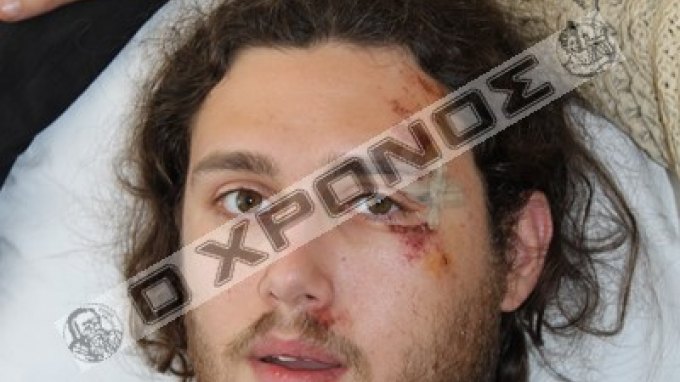 Αρνήθηκε να πληρώσει χωρίς απόδειξη και ξυλοκοπήθηκε