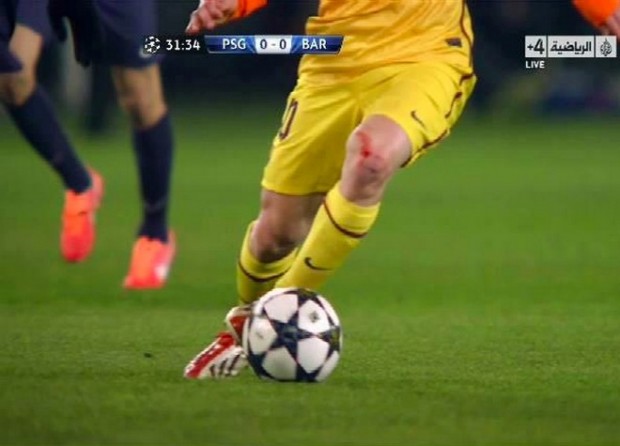 Φόβοι για Μέσι, νοκ άουτ ο Μασεράνο