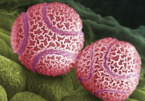 ΦΩΤΟ-Ζωντανοί οργανισμοί στο μικροσκόπιο