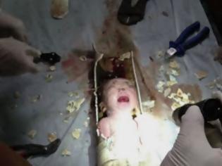 Κίνα:Καλά στην υγεία του το νεογέννητο που πέταξαν σε αποχέτευση