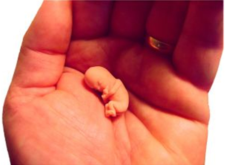 Αρνήθηκαν άμβλωση σε άρρωστη εγκυμονούσα