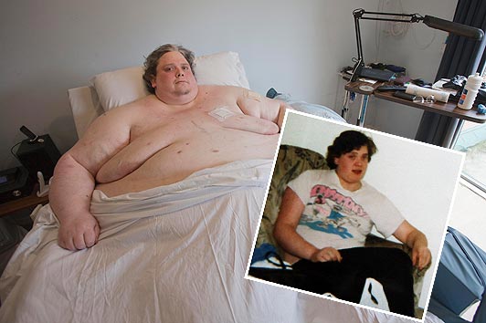 Ο πιο παχύς άνθρωπος του κόσμου