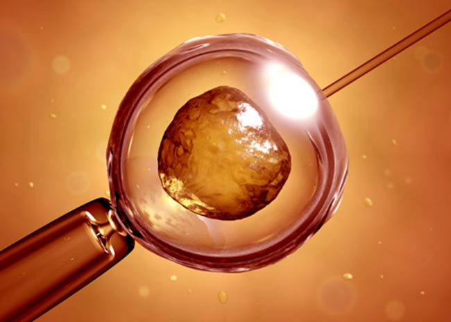 Ποιο είναι το όριο ηλικίας για την εξωσωματική;