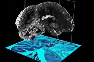 Έφτιαξαν τον λεπτομερέστερο ψηφιακό εγκέφαλο