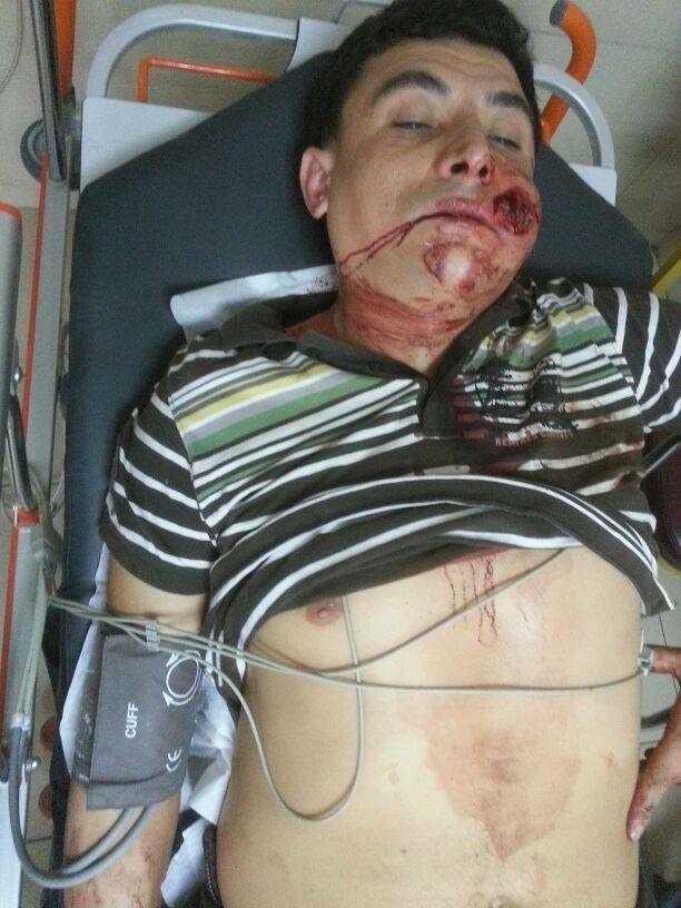 Σοκαριστικές εικόνες από την Κωνσταντινούπολη