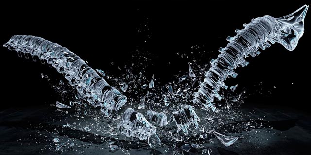 Συμβουλές για την οστεοπόρωση