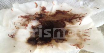 Οι βρύσες…τρέχουν σκουλήκια