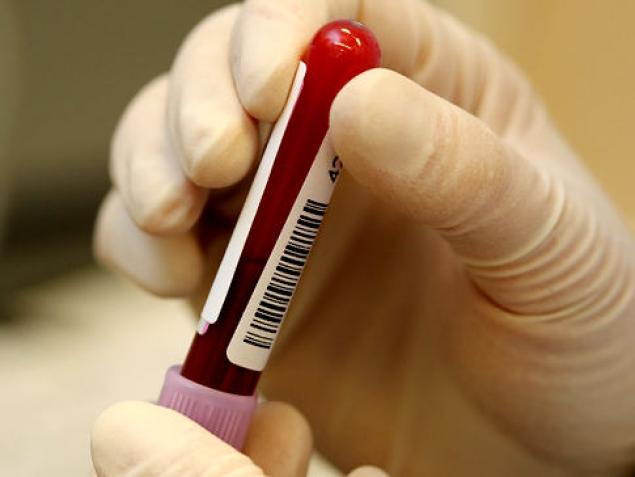 Ανδρολογικό check up απαραίτητο σε ηλικίες άνω των 35