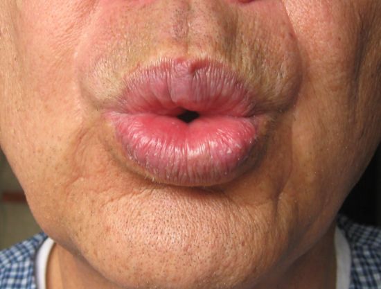 ΒΙΝΤΕΟ-Διαγωνισμός… σφυρίγματος!