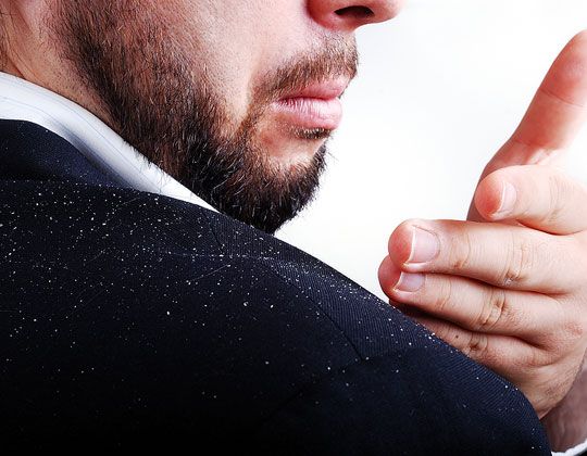 Ξηροδερμία του τριχωτού της κεφαλής. Πώς αντιμετωπίζεται;