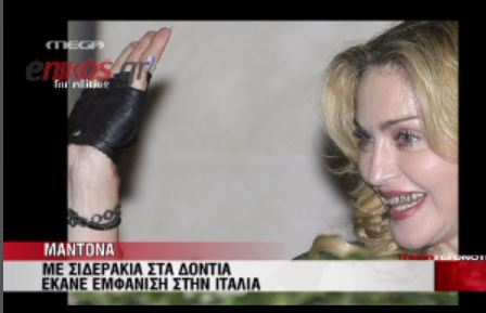 ΒΙΝΤΕΟ-Η εμφάνιση της Μαντόνα με σιδεράκια