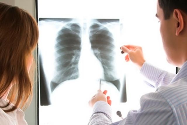 Τι είναι το πνευμονικό οίδημα και που μπορεί να οφείλεται