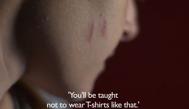 ΒΙΝΤΕΟ-“Με σημάδεψαν Χρυσαυγίτες”