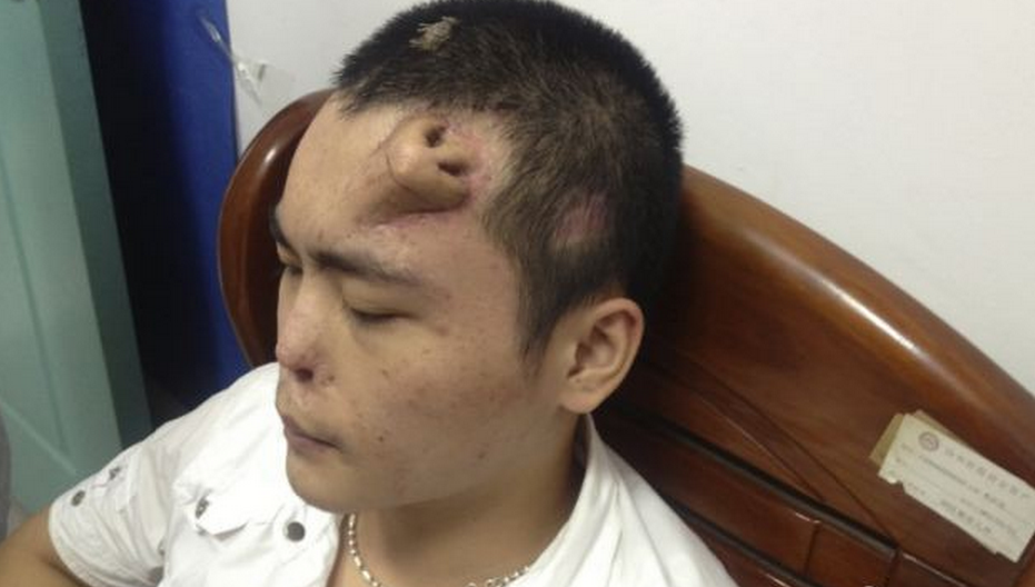 Του “έφτιαξαν” μύτη στο μέτωπο!