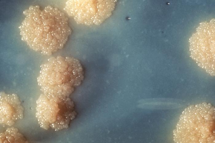 Ανακάλυψαν τη γενέτειρα της φυματίωσης