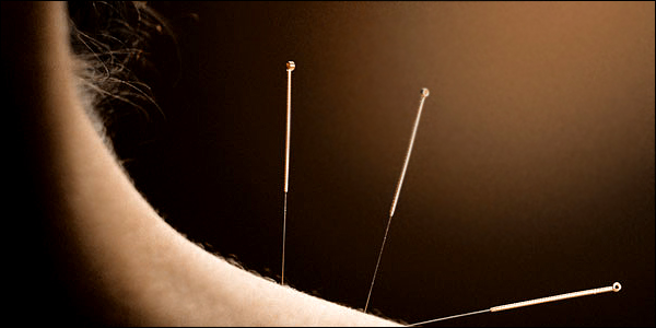 Mπορώ να κόψω το κάπνισμα με τον βελονισμό;