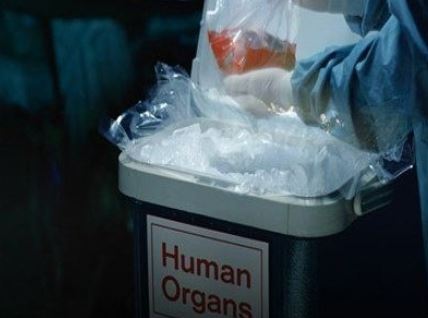 Συνέλαβαν Έλληνα για εμπόριο νεφρών