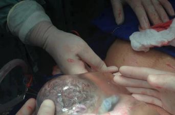 ΦΩΤΟ- Το πέπλο της γέννησης