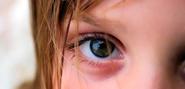 Μάτια και ψυχικά τραύματα…