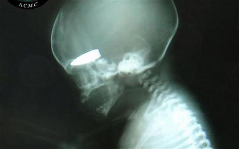 ΒΙΝΤΕΟ- Συρία: «Σκοποβολή σε ζωντανούς στόχους»