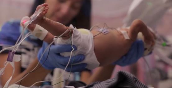 ΒΙΝΤΕΟ-Ζύγιζε μόλις 670 γραμμάρια κι όμως τα κατάφερε