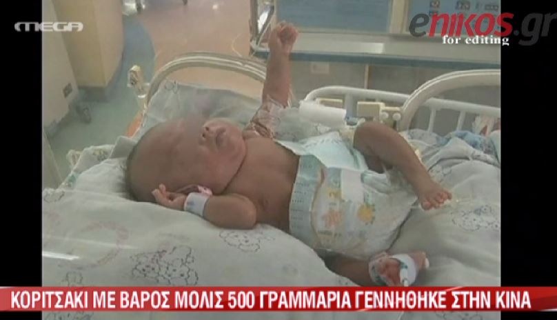 ΒΙΝΤΕΟ-Το πιο ελαφρύ μωρό στον κόσμο