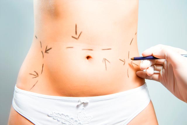 Αποκτήστε το σώμα που ονειρεύεστε με το ίδιο σας το λίπος