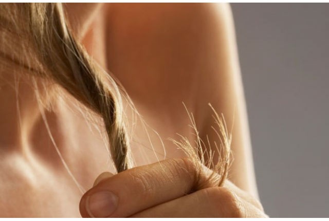 Γυναικεία τριχόπτωση: Μέθοδοι πρόληψης και αντιμετώπισης
