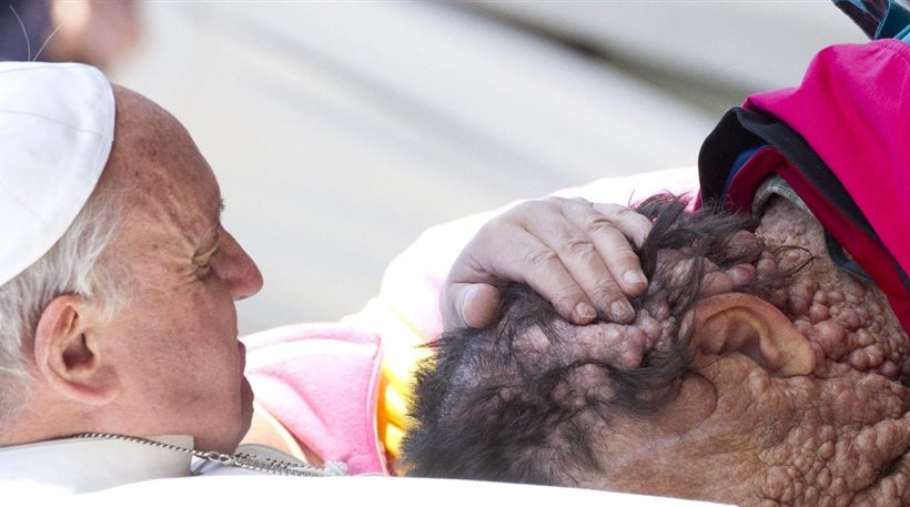 ΦΩΤΟ-Το φιλί του Πάπα στον παραμορφωμένο ασθενή