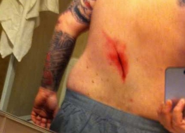 ΦΩΤΟ- Μαχαιρώματα στο Τορίνο