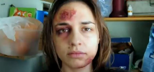 ΒΙΝΤΕΟ-Ένας χρόνος κακοποίησης μέσα σε 1 λεπτό