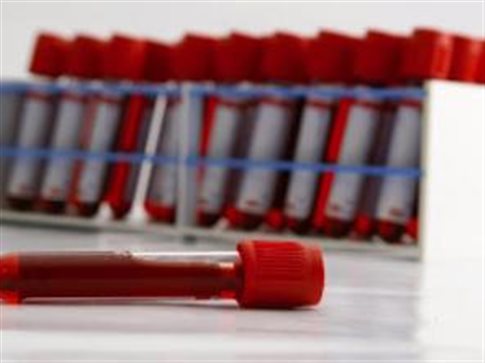 Unicef: Αύξηση-σοκ των θανάτων εφήβων από HIV