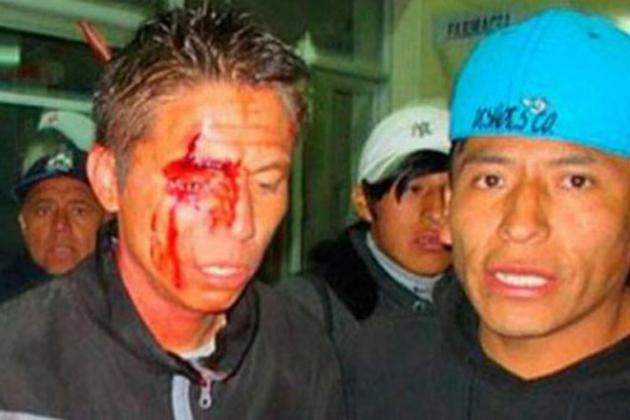 ΒΙΝΤΕΟ-Έχασε πέναλτι & του άνοιξαν το κεφάλι