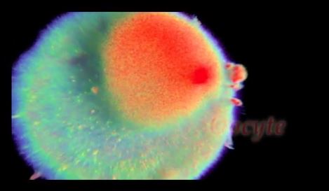 ΒΙΝΤΕΟ-Το θαύμα της ζωής