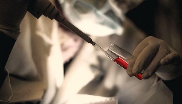 Τι πρέπει να τρως πριν από μια εξέταση αίματος