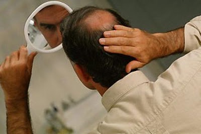 Το γονίδιο – κλειδί για τη φαλάκρα