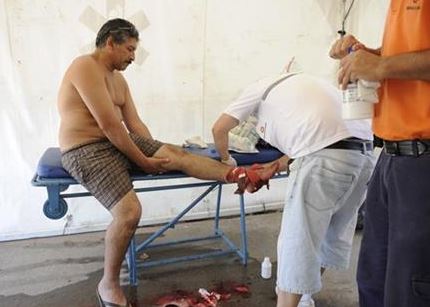 ΦΩΤΟ-Πιράνχας τραυμάτισαν 70 άτομα σε ποταμό