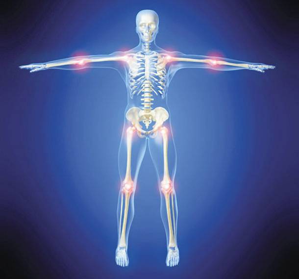 Πώς να αντιμετωπίσετε την οστεοαρθρίτιδα